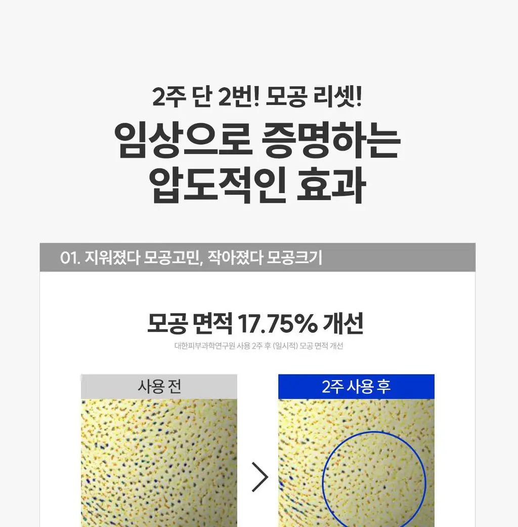 [모공순삭/피지쓱싹] 로벡틴 닥터마스크 포어 1매 상세페이지 26